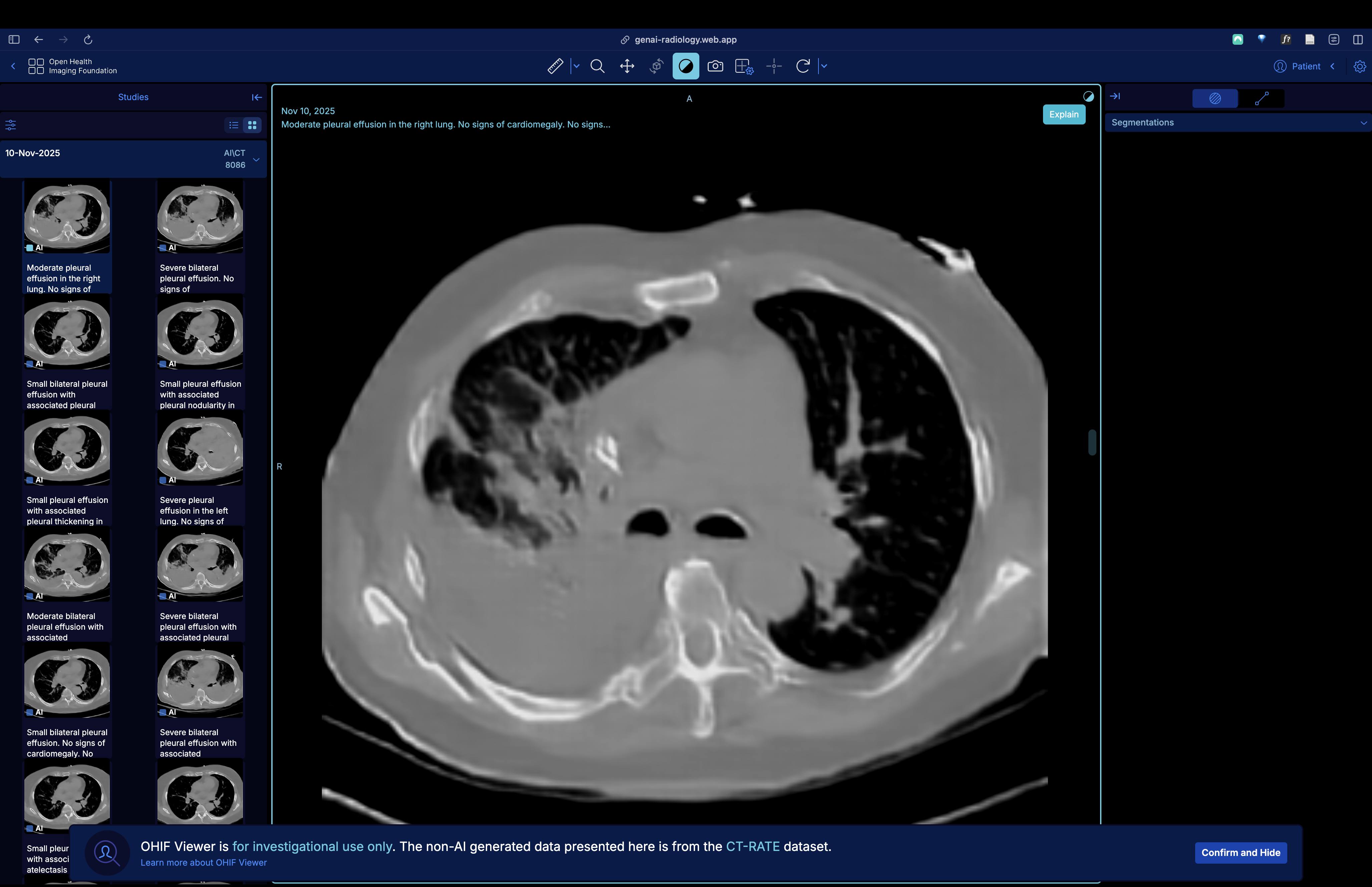 Text-to-CT Scan Generative AI project thumbnail